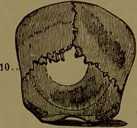 An illustration from Fowler's New illustrated self-instructor in phrenology and physiology : with over one hundred engravings, together with the chart and character of ... as marked by ... / by Lorenzo N. Fowler. (1895)