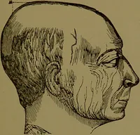 Picture 27 of 69 from Fowler's New illustrated self-instructor in phrenology and physiology : with over one hundred engravings, together with the chart and character of ... as marked by ... / by Lorenzo N. Fowler. (1895), leaf 77
