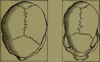 An illustration from A new illustrated hand-book of phrenology, physiology and physiognomy / by R.B.D. Wells. (1870)