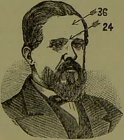 Picture 93 of 130 from A new illustrated hand-book of phrenology, physiology and physiognomy / by R.B.D. Wells. (1870), leaf 255
