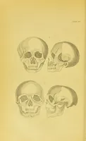 Picture 41 of 74 from Essays on physiognomy / translated from the German of John Caspar Lavater, by Thomas Holcroft. Also one hundred physiognomical rules, taken from a posthumous work of J. C. Lavater ; and a memoir of the author. (1880), leaf 454