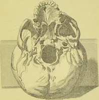 Picture 48 of 74 from Essays on physiognomy / translated from the German of John Caspar Lavater, by Thomas Holcroft. Also one hundred physiognomical rules, taken from a posthumous work of J. C. Lavater ; and a memoir of the author. (1880), leaf 475