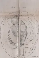 An illustration from Traité sur la nouvelle physiologie du cerveau, ou, Exposition de la doctrine de Gall sur la structure et les fonctions de cet organe : ouvrage accompagné de beaucoup de notes sur différens points de cette doctrine, et orné de planches / par J. B. Nacquart. (1808)