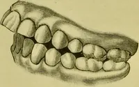 An illustration from A system of practical and scientific physiognomy, or, How to read faces : being a manual of instruction in the knowledge of the human physiognomy and organism, embracing the discoveries of located signs of character in the body and face, as shown by the five natural divisions of the countenance. Volume 2 / by Mary Olmstead Stanton. (1890)