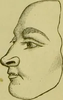 An illustration from A system of practical and scientific physiognomy, or, How to read faces : being a manual of instruction in the knowledge of the human physiognomy and organism, embracing the discoveries of located signs of character in the body and face, as shown by the five natural divisions of the countenance. Volume 2 / by Mary Olmstead Stanton. (1890)