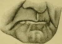 An illustration from A system of practical and scientific physiognomy, or, How to read faces : being a manual of instruction in the knowledge of the human physiognomy and organism, embracing the discoveries of located signs of character in the body and face, as shown by the five natural divisions of the countenance. Volume 2 / by Mary Olmstead Stanton. (1890)