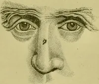 An illustration from A system of practical and scientific physiognomy, or, How to read faces : being a manual of instruction in the knowledge of the human physiognomy and organism, embracing the discoveries of located signs of character in the body and face, as shown by the five natural divisions of the countenance. Volume 2 / by Mary Olmstead Stanton. (1890)
