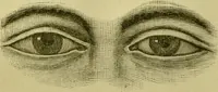 An illustration from A system of practical and scientific physiognomy, or, How to read faces : being a manual of instruction in the knowledge of the human physiognomy and organism, embracing the discoveries of located signs of character in the body and face, as shown by the five natural divisions of the countenance. Volume 2 / by Mary Olmstead Stanton. (1890)