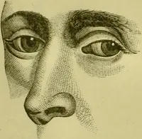 Picture 69 of 165 from A system of practical and scientific physiognomy, or, How to read faces : being a manual of instruction in the knowledge of the human physiognomy and organism, embracing the discoveries of located signs of character in the body and face, as shown by the five natural divisions of the countenance. Volume 2 / by Mary Olmstead Stanton. (1890), leaf 369
