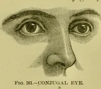 An illustration from A system of practical and scientific physiognomy, or, How to read faces : being a manual of instruction in the knowledge of the human physiognomy and organism, embracing the discoveries of located signs of character in the body and face, as shown by the five natural divisions of the countenance. Volume 2 / by Mary Olmstead Stanton. (1890)