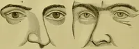 An illustration from A system of practical and scientific physiognomy, or, How to read faces : being a manual of instruction in the knowledge of the human physiognomy and organism, embracing the discoveries of located signs of character in the body and face, as shown by the five natural divisions of the countenance. Volume 2 / by Mary Olmstead Stanton. (1890)