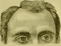 An illustration from A system of practical and scientific physiognomy, or, How to read faces : being a manual of instruction in the knowledge of the human physiognomy and organism, embracing the discoveries of located signs of character in the body and face, as shown by the five natural divisions of the countenance. Volume 2 / by Mary Olmstead Stanton. (1890)