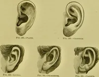 Picture 105 of 165 from A system of practical and scientific physiognomy, or, How to read faces : being a manual of instruction in the knowledge of the human physiognomy and organism, embracing the discoveries of located signs of character in the body and face, as shown by the five natural divisions of the countenance. Volume 2 / by Mary Olmstead Stanton. (1890), leaf 449