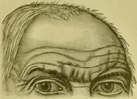 An illustration from A system of practical and scientific physiognomy, or, How to read faces : being a manual of instruction in the knowledge of the human physiognomy and organism, embracing the discoveries of located signs of character in the body and face, as shown by the five natural divisions of the countenance. Volume 2 / by Mary Olmstead Stanton. (1890)