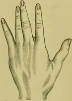 An illustration from A system of practical and scientific physiognomy, or, How to read faces : being a manual of instruction in the knowledge of the human physiognomy and organism, embracing the discoveries of located signs of character in the body and face, as shown by the five natural divisions of the countenance. Volume 2 / by Mary Olmstead Stanton. (1890)