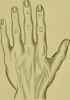 An illustration from A system of practical and scientific physiognomy, or, How to read faces : being a manual of instruction in the knowledge of the human physiognomy and organism, embracing the discoveries of located signs of character in the body and face, as shown by the five natural divisions of the countenance. Volume 2 / by Mary Olmstead Stanton. (1890)