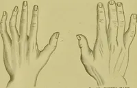 An illustration from A system of practical and scientific physiognomy, or, How to read faces : being a manual of instruction in the knowledge of the human physiognomy and organism, embracing the discoveries of located signs of character in the body and face, as shown by the five natural divisions of the countenance. Volume 2 / by Mary Olmstead Stanton. (1890)