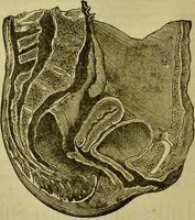 An illustration from A system of practical and scientific physiognomy, or, How to read faces : being a manual of instruction in the knowledge of the human physiognomy and organism, embracing the discoveries of located signs of character in the body and face, as shown by the five natural divisions of the countenance. Volume 2 / by Mary Olmstead Stanton. (1890)