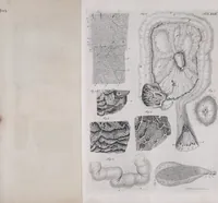 An illustration from Pfennig-Encyklopädie der Anatomie, oder, Bildliche Darstellung der gesammten menschlichen Anatomie : nach Rosenmüller, Loder, Carl Bell, Gordon, Bock etc / gestochen von J.F. Schröter ; mit erklärendem Texte von. Th. Richter. (1834)