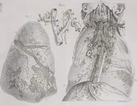 Picture 62 of 68 from Pfennig-Encyklopädie der Anatomie, oder, Bildliche Darstellung der gesammten menschlichen Anatomie : nach Rosenmüller, Loder, Carl Bell, Gordon, Bock etc / gestochen von J.F. Schröter ; mit erklärendem Texte von. Th. Richter. (1834), leaf 609