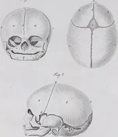 Picture 9 of 68 from Pfennig-Encyklopädie der Anatomie, oder, Bildliche Darstellung der gesammten menschlichen Anatomie : nach Rosenmüller, Loder, Carl Bell, Gordon, Bock etc / gestochen von J.F. Schröter ; mit erklärendem Texte von. Th. Richter. (1834), leaf 71