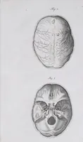 Picture 16 of 68 from Pfennig-Encyklopädie der Anatomie, oder, Bildliche Darstellung der gesammten menschlichen Anatomie : nach Rosenmüller, Loder, Carl Bell, Gordon, Bock etc / gestochen von J.F. Schröter ; mit erklärendem Texte von. Th. Richter. (1834), leaf 75