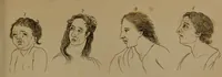 An illustration from Essays on physiognomy : designed to promote the knowledge and the love of mankind / written in the German language by John Caspar Lavater ; and translated into English by Thomas Holcroft ; to which are added one hundred physiognomonical rules, a posthumous work by Mr. Lavater and Memoirs of the life of the author compiled principally from The Life of Lavater, by G. Gessner. (1850)