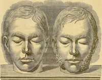 An illustration from Manual of phrenology : as an accompaniment to the phrenological bust / [James De Ville]. (1835)