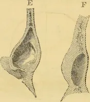 Picture 10 of 20 from Manual of phrenology : as an accompaniment to the phrenological bust / [James De Ville]. (1835), leaf 42