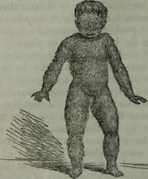 An illustration from The midwife's guide : being the complete works of Aristotle : beautifully illustrated. To which is added an appendix, explanatory of the illustrations, never before published. (1845)