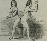 An illustration from The midwife's guide : being the complete works of Aristotle : beautifully illustrated. To which is added an appendix, explanatory of the illustrations, never before published. (1845)