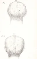 An illustration from Phrenology, or the doctrine of the mind : and of the relations between its manifestations and the body. (1825)