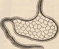 An illustration from The confessional ... An analysis of the causes and cure of melancholy, nervousness, mental and physical debility, arising from ill health, worldly anxiety ... To which is added an essay on corpulency-obesity ... A sketch of choice in marriage, phrenologically considered ... and a few comments on drunkenness / [Robert James Culverwell]. (1841)