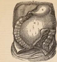 An illustration from The confessional ... An analysis of the causes and cure of melancholy, nervousness, mental and physical debility, arising from ill health, worldly anxiety ... To which is added an essay on corpulency-obesity ... A sketch of choice in marriage, phrenologically considered ... and a few comments on drunkenness / [Robert James Culverwell]. (1841)
