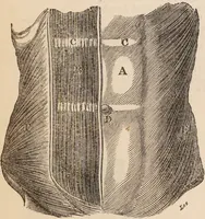 An illustration from The confessional ... An analysis of the causes and cure of melancholy, nervousness, mental and physical debility, arising from ill health, worldly anxiety ... To which is added an essay on corpulency-obesity ... A sketch of choice in marriage, phrenologically considered ... and a few comments on drunkenness / [Robert James Culverwell]. (1841)