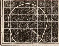An illustration from Outlines of phrenology / [George Combe]. (1835)