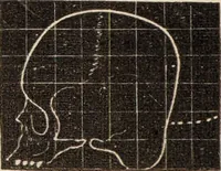 Picture 5 of 47 from Outlines of phrenology / [George Combe]. (1838), leaf 18