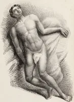 An illustration from Memoria di spontanea e singolare guarigione di un' aneurisma della femorale primitiva : osservato dalla maggior parte de' chirurgi, e medici degl' incurabili / scritta da Francesco Calise, chirurgo ordinario dell' ospedale suddetto. (1842)