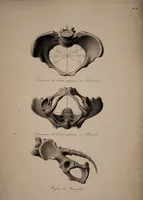 Picture 2 of 3 from Nouvelles démonstrations d'accouchemens. Avec des planches en taille-douce, accompagnées d'un texte raisonné, propre à en faciliter l'explication ... / Par J.-P. Maygrier. (1822), leaf 11