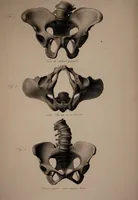 An illustration from Nouvelles démonstrations d'accouchemens. Avec des planches en taille-douce, accompagnées d'un texte raisonné, propre à en faciliter l'explication ... / Par J.-P. Maygrier. (1822)