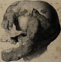 An illustration from Atlas der Cranioscopie, oder, Abbildungen der Schaedel- und Antlitzformen beruehmter oder sonst merkwuerdiger Personen / von Carl Gustav Carus. (1843)