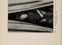 An illustration from Phenomena of materialisation : a contribution to the investigation of mediumistic teleplastics / by Baron von Schrenck Notzing ; translated by E.E. Fournier d'Albe. (1923)