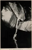 Picture 33 of 127 from Phenomena of materialisation : a contribution to the investigation of mediumistic teleplastics / by Baron von Schrenck Notzing ; translated by E.E. Fournier d'Albe. (1923), leaf 203