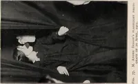 Picture 37 of 127 from Phenomena of materialisation : a contribution to the investigation of mediumistic teleplastics / by Baron von Schrenck Notzing ; translated by E.E. Fournier d'Albe. (1923), leaf 225