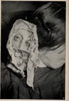 Picture 40 of 127 from Phenomena of materialisation : a contribution to the investigation of mediumistic teleplastics / by Baron von Schrenck Notzing ; translated by E.E. Fournier d'Albe. (1923), leaf 238