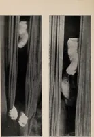 An illustration from Phenomena of materialisation : a contribution to the investigation of mediumistic teleplastics / by Baron von Schrenck Notzing ; translated by E.E. Fournier d'Albe. (1923)