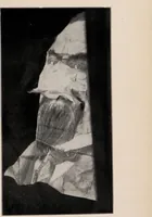 An illustration from Phenomena of materialisation : a contribution to the investigation of mediumistic teleplastics / by Baron von Schrenck Notzing ; translated by E.E. Fournier d'Albe. (1923)