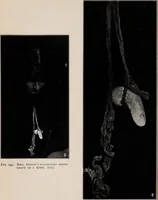 Picture 70 of 127 from Phenomena of materialisation : a contribution to the investigation of mediumistic teleplastics / by Baron von Schrenck Notzing ; translated by E.E. Fournier d'Albe. (1923), leaf 362