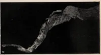 An illustration from Phenomena of materialisation : a contribution to the investigation of mediumistic teleplastics / by Baron von Schrenck Notzing ; translated by E.E. Fournier d'Albe. (1923)