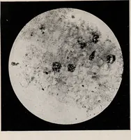 An illustration from Phenomena of materialisation : a contribution to the investigation of mediumistic teleplastics / by Baron von Schrenck Notzing ; translated by E.E. Fournier d'Albe. (1923)